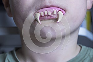 Close up view of toy vampire teeth in child`s mouth. Halloween, prank concept.