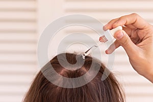 Close up view of unrecognizable young man with long hair putting hair growth lotion with a pippet in the head