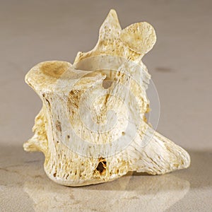 Close up view of a vertebrae of human backbone