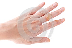 Close-up of the water blister on the finger on a white background