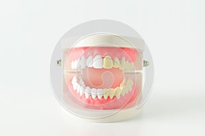Close up of white and yellow teeth model with red gum on white b
