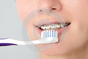 Close-up of woman with braces brushing her teeth. Orthodontics and dental care. Photo