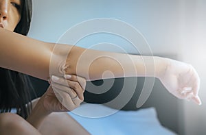 Close up of woman with dry skin on elbow and arm,Body and health care concept