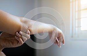 Close up of woman with dry skin on elbow and arm,Body and health care concept