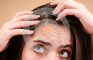 Close up of woman examining her scalp and hair, hair loss on hairline or dry scalp problem.