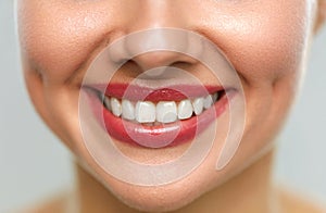 Close Up Of Woman Mouth With Beautiful Smile And White Teeth