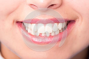 Close-up of woman mouth with perfect white teeth