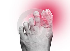 Close up of woman right foot with a wounded on big toe. Isolated on white background. Accident and health care concept. Black and