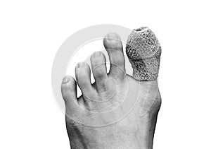 Close up of woman right foot with a wounded on big toe. Isolated on white background. Accident and health care concept . Black and