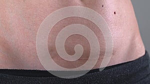Close up of woman`s belly with cesarean scar. Postpartum recovery. Baby delivery operation. Fit woman after birth