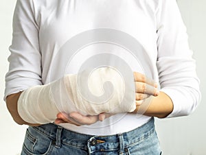 Close-up of a woman's broken arm in plasterboard.