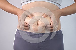 Close-up of woman`s hand pinching excessive belly fat  on gray background. Woman fat belly. Obesity and Overweight Concep