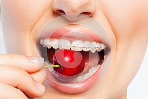 Woman with dental braces biting off ripe cherry photo