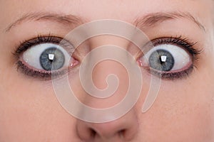 Close up, woman is squinting, concept strabismus and squint photo