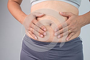 Close up of Woman touching belly skin with stretch marks and loose skin after giving birth. Health care for skin and body shape co