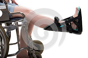 Close up of woman in wheelchair and  night splint foot orthosis