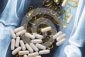 Close-up of X-ray image and different pills and capsules photo