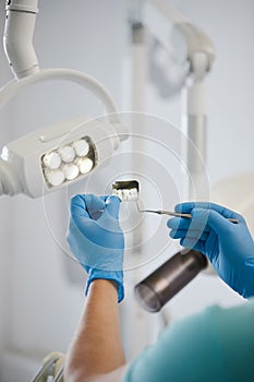 Close up x-ray of several teeth in hands of dentist who will conduct diagnosis.