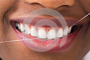 African Woman Flossing Teeth
