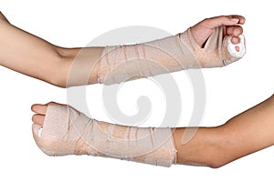 Close up of young Asian boy with arm plaster fiberglass cast covering the wrist finger and arm.