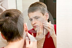 Close up of young attractive man with problematic skin and scars from acne looks in the mirror in the bathroom