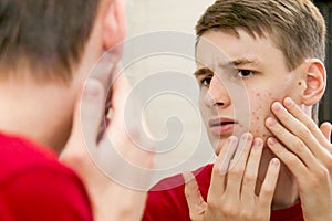 Close up of young attractive man with problematic skin and scars from acne looks in the mirror in the bathroom