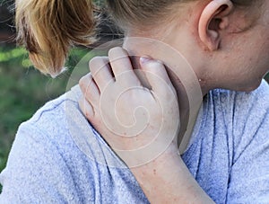 Girl With Eczema Scratching Neck photo