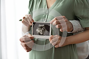 Close up of young parents hold ultrasound picture