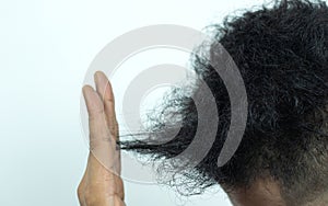 Close Up Young people have problems with hair loss, dryness, dullness, split ends and damage