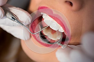 Close up of young woman having dental check up in dental office. Dentist examining a patient`s teeth with dental tools