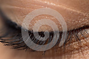 Closed eyelid closeup