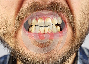 Closed human teeth grin, small gap, closeup