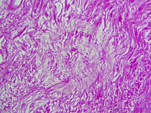 A Closer Look at the Dermis: Dense Irregular Connective Tissue in Detailed View photo