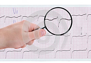 Closer look at ECG printout