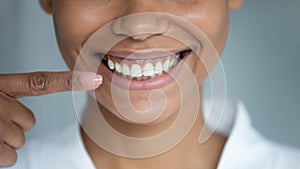 Closeup african woman point finger at perfect white toothy smile