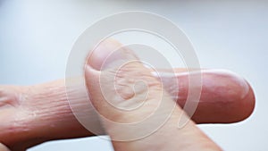 Closeup applying treatment cream on a finger