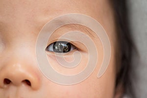 Closeup Asian infant baby eye