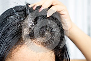 Closeup Asian woman having problem with grey, white hair growing up