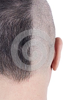 Closeup of the Back of a Man`s Head Half Shaven photo