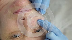 closeup beautician removes acne on a woman's face with a needle