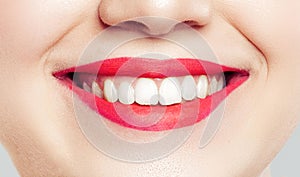 Closeup of beautiful smile with white teeth. Woman mouth smiling