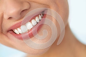 Closeup Of Beautiful Smile With White Teeth. Woman Mouth Smiling