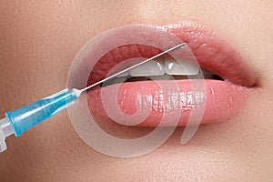 Closeup of beautiful woman gets injection in her face. Full lips. Beautiful face and the syringe plastic surgery and cosmetic