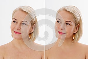 Closeup before after Beauty middle age woman face portrait. Before-after Spa anti wrinkled aging female body parts concept. Mid-