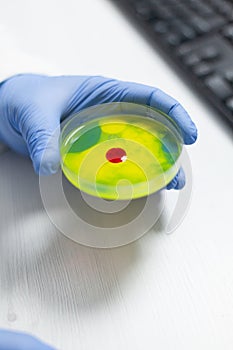 Closeup of biologist man holding medical petri dish with bacteria sample in it