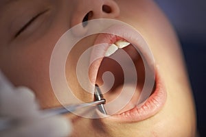 Closeup, child and dentist with mirror in mouth for gum disease and oral hygiene with dental inspection. Medical