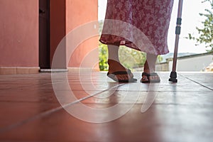 Closeup of the crippled and lame legs of a woman girl suffering from walking problems