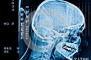 Closeup of a CT