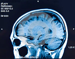 Closeup of a CT scan woman brain.