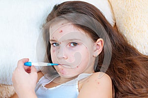 Closeup of cute sad little girl. Varicella virus or Chickenpox bubble rash on child